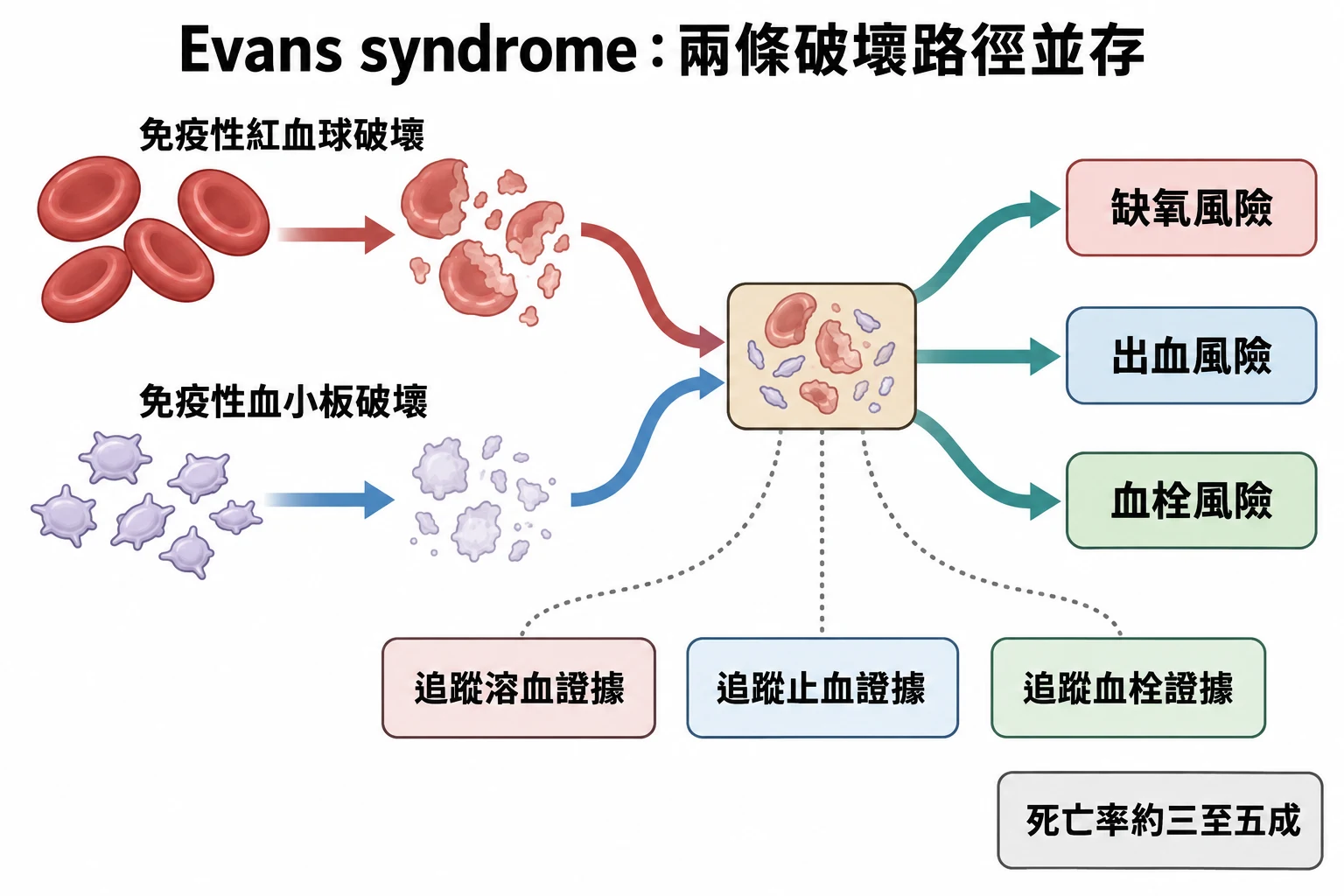 Evans syndrome:兩條破壞路徑並存教學插圖