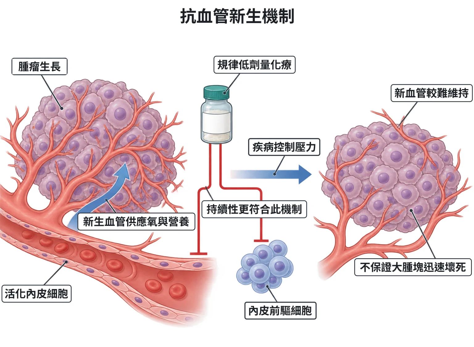 抗血管新生機制教學插圖