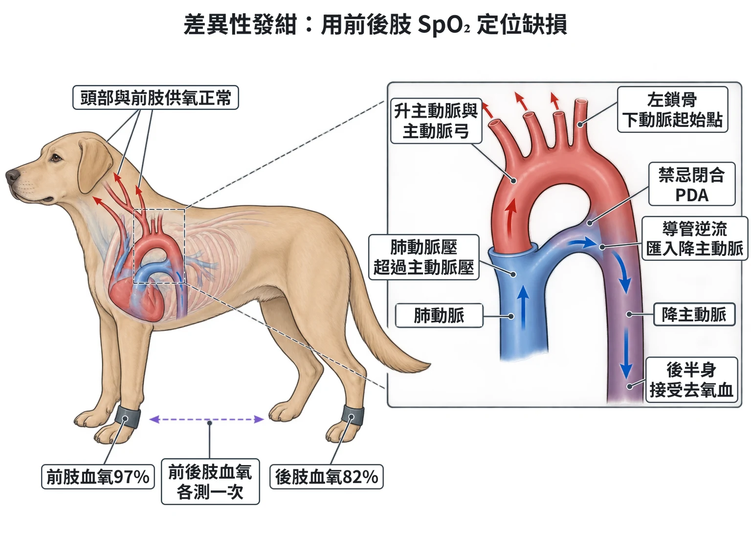 差異性發紺:用前後肢 SpO₂ 定位缺損教學插圖