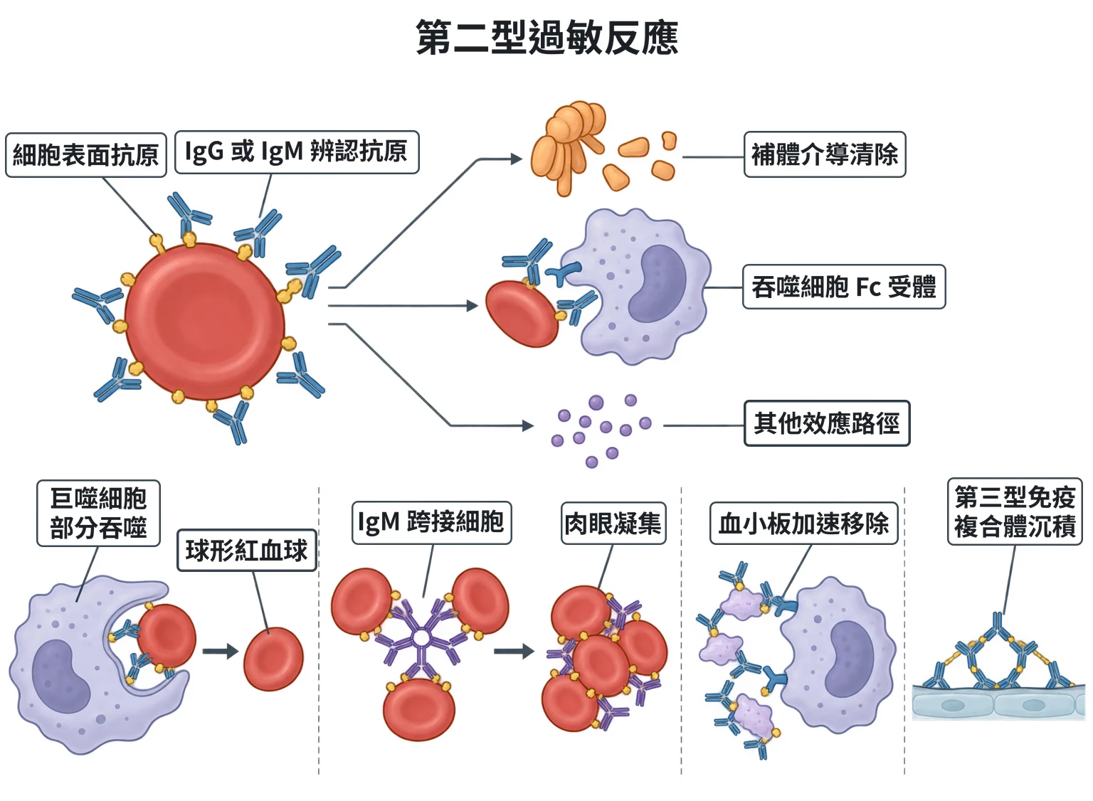 第二型過敏反應教學插圖