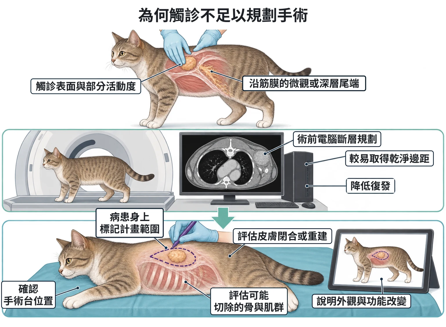 為何觸診不足以規劃手術教學插圖