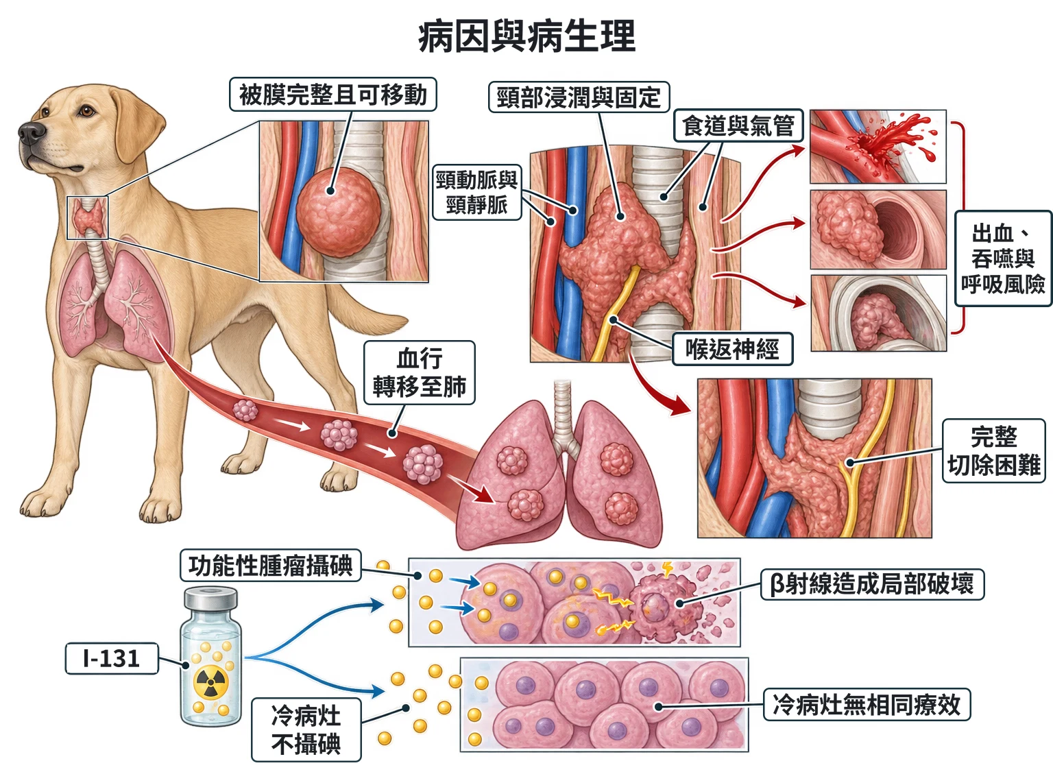 病因與病生理教學插圖