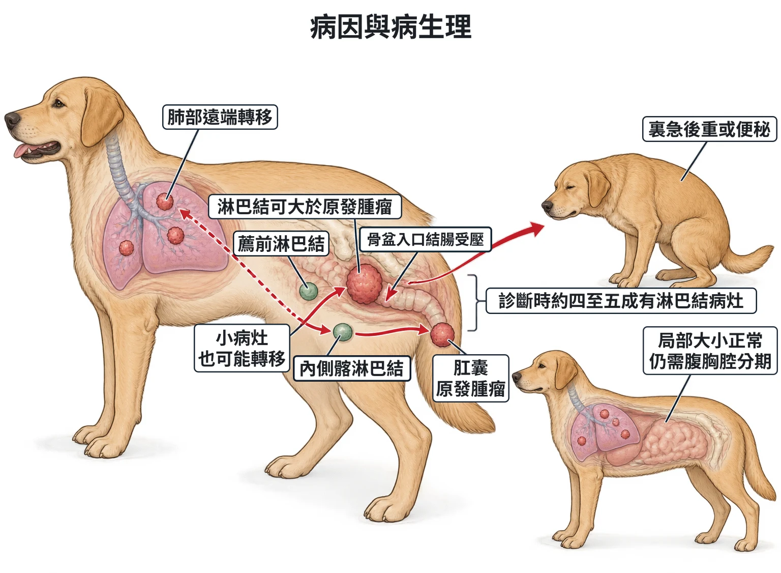 病因與病生理教學插圖