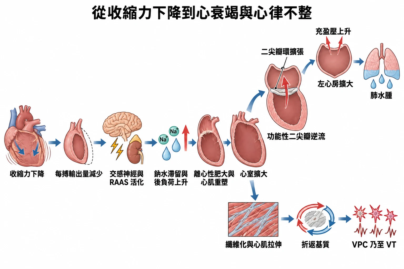 從收縮力下降到心衰竭與心律不整教學插圖