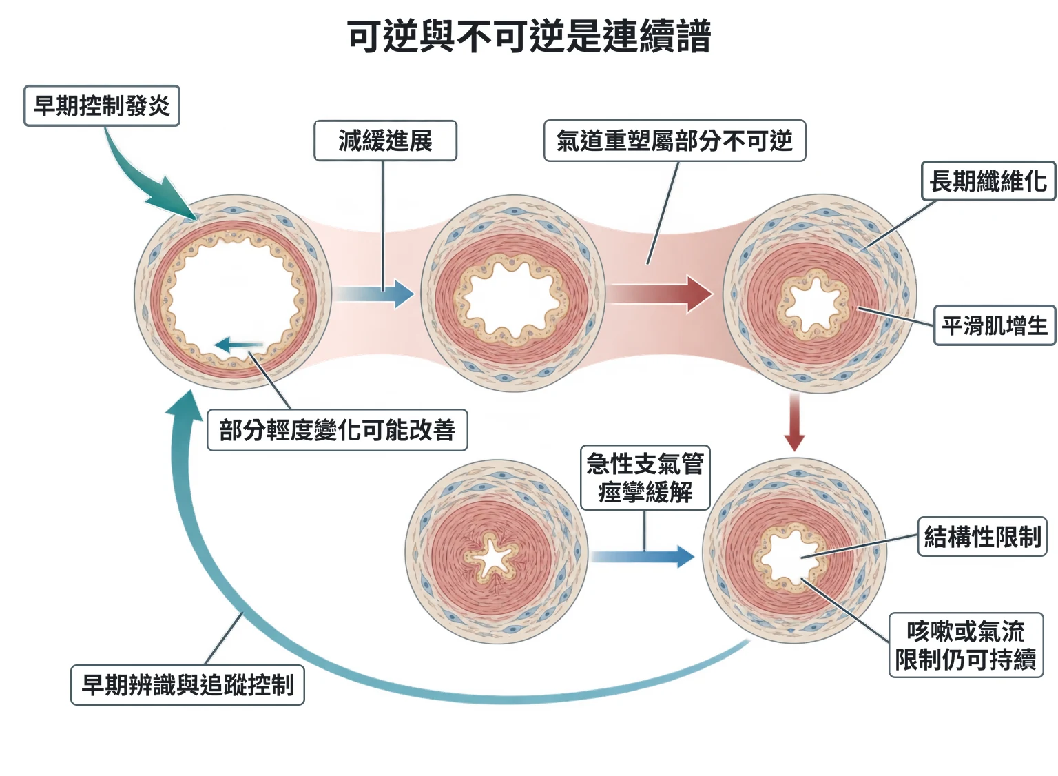 可逆與不可逆是連續譜教學插圖