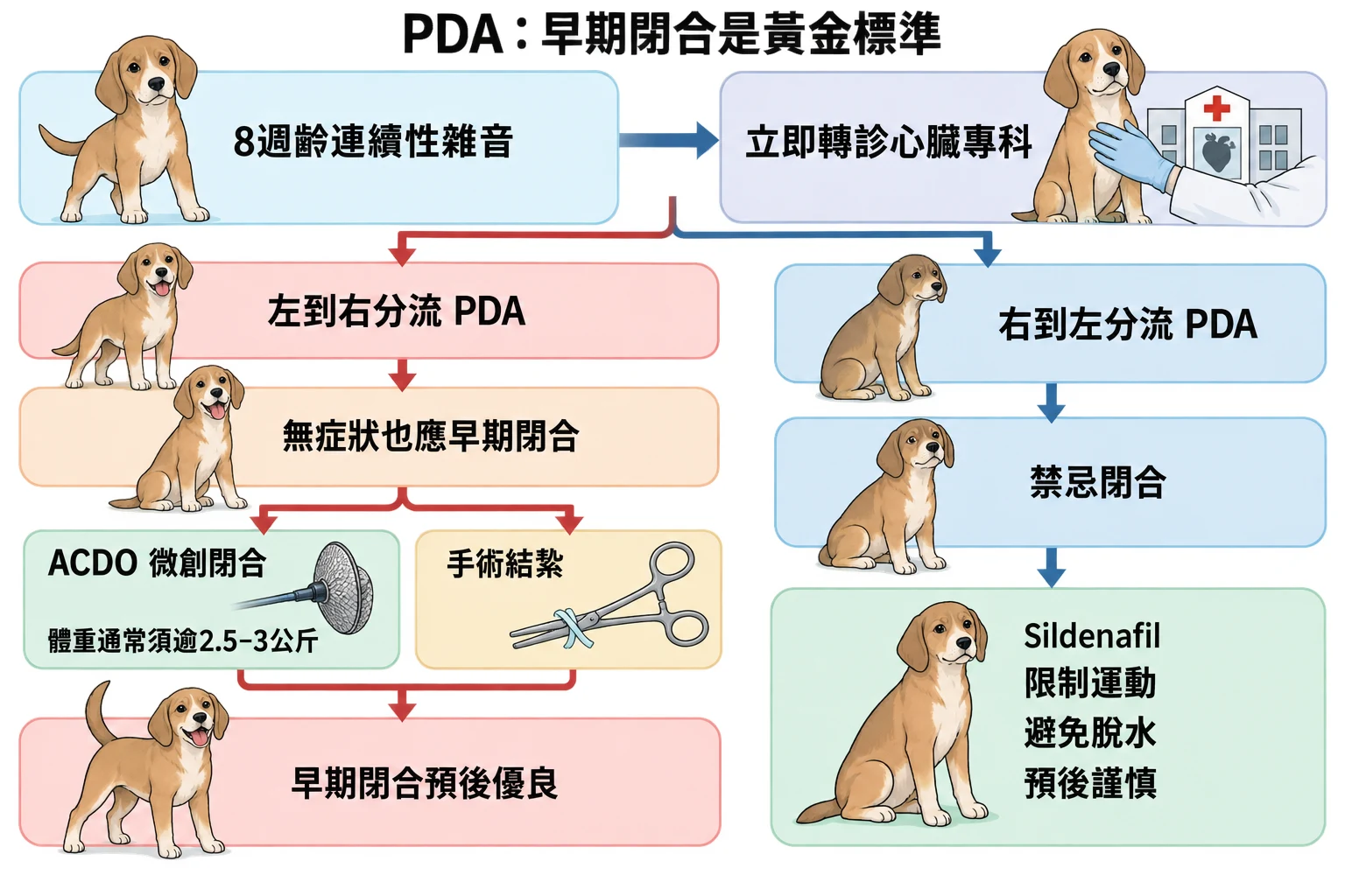 PDA:早期閉合是黃金標準教學插圖