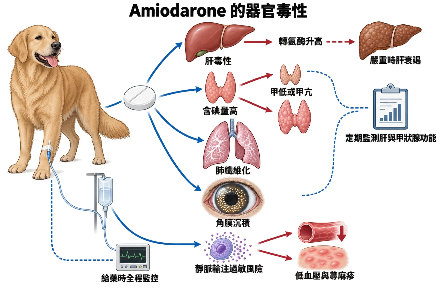 Amiodarone 的器官毒性教學插圖