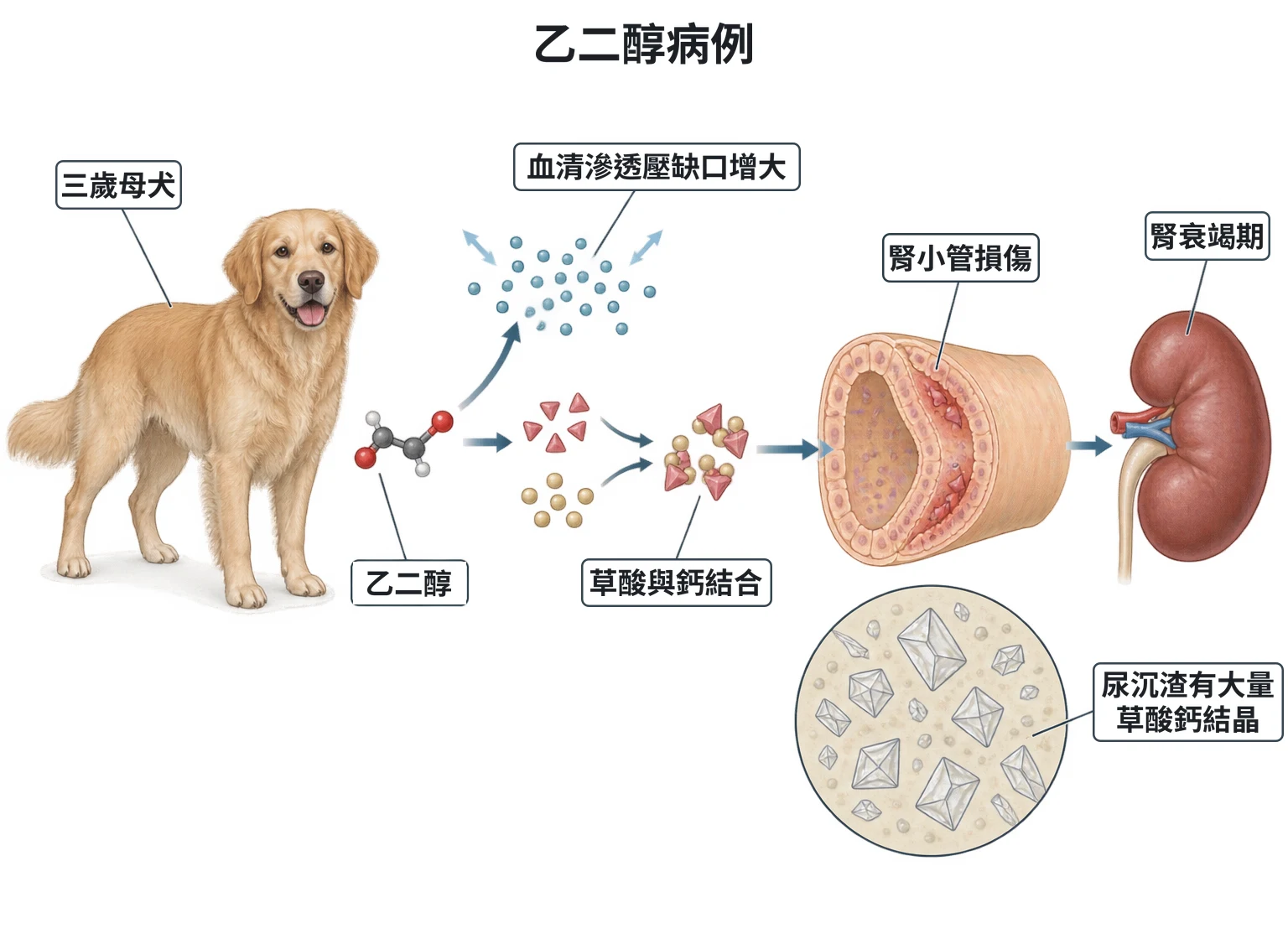 乙二醇病例教學插圖