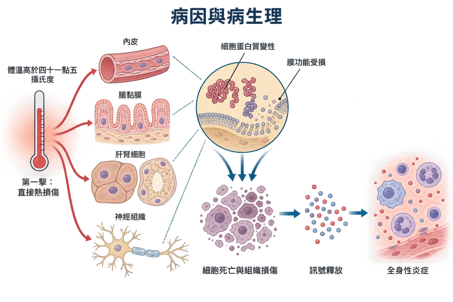 病因與病生理教學插圖