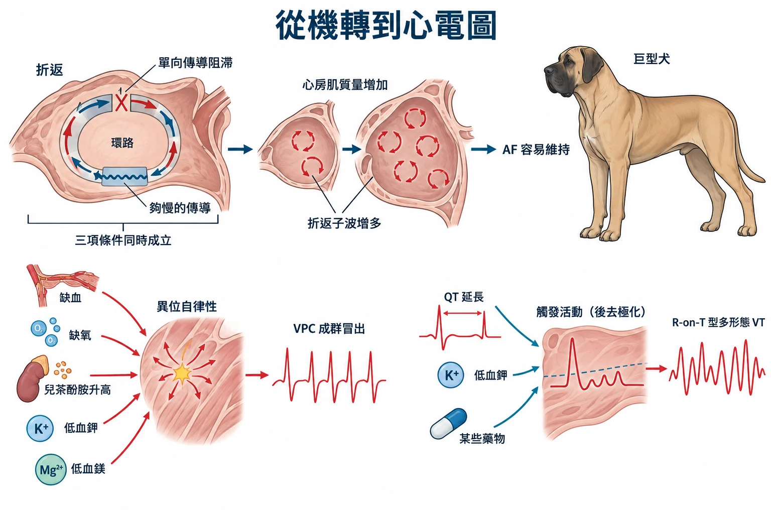 從機轉到心電圖教學插圖
