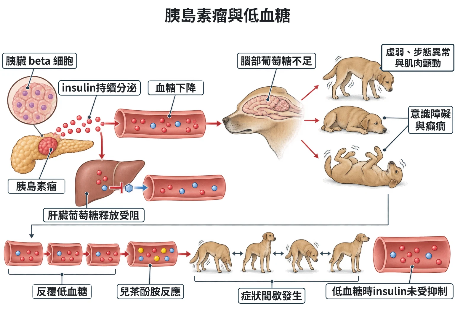胰島素瘤與低血糖教學插圖