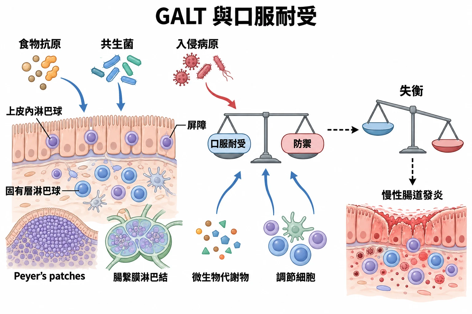GALT 與口服耐受教學插圖
