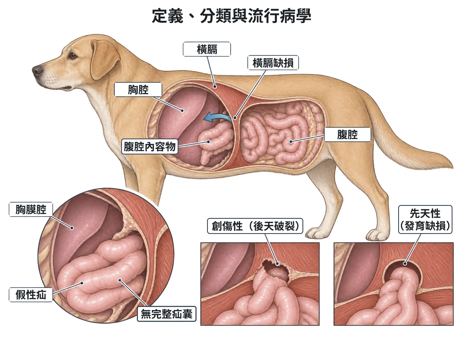 定義、分類與流行病學教學插圖