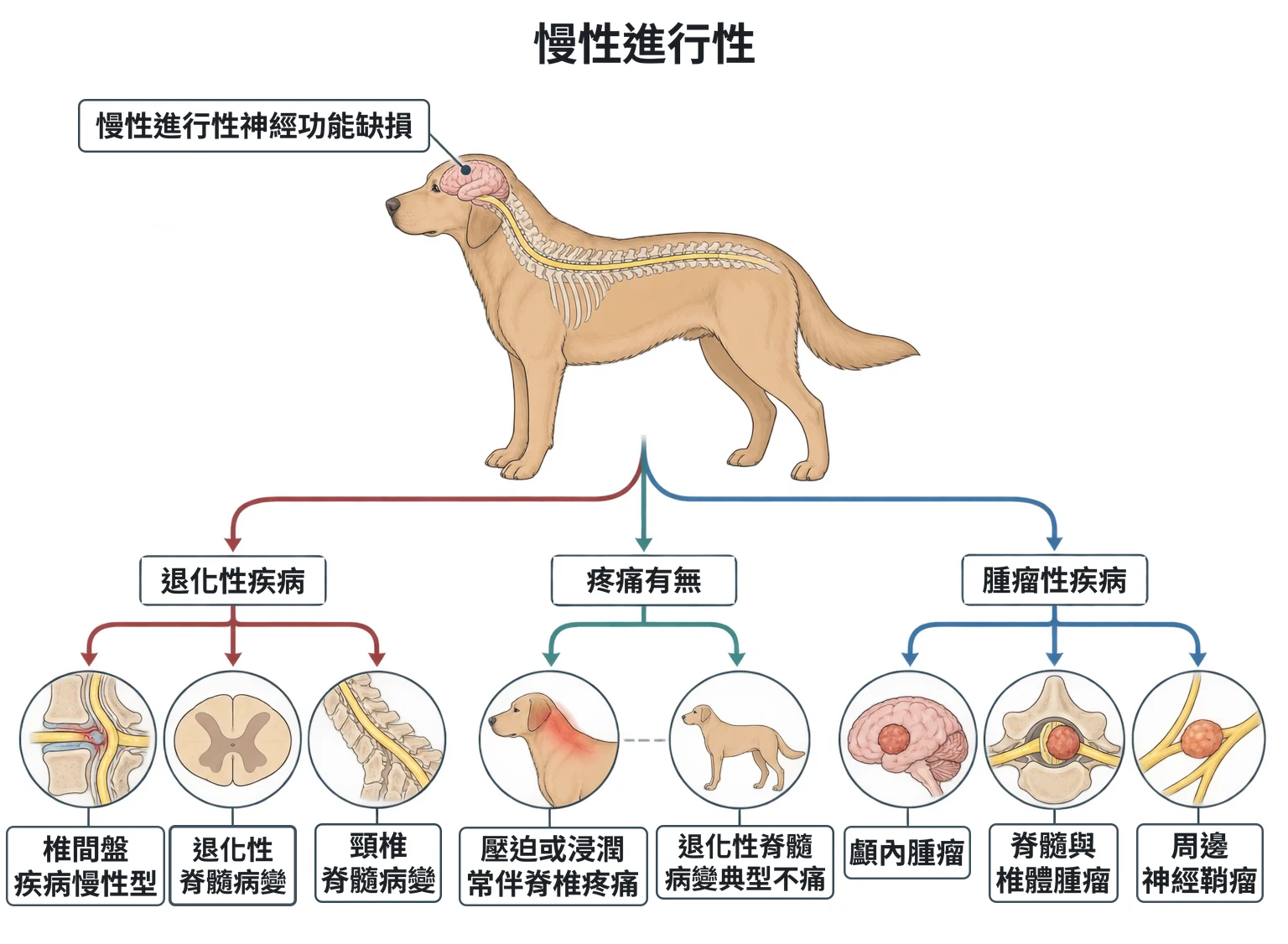 慢性進行性教學插圖