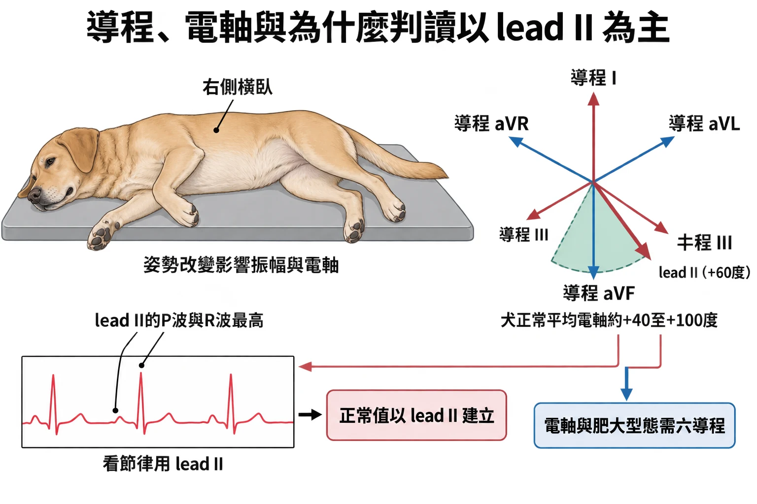 導程、電軸與為什麼判讀以 lead II 為主教學插圖