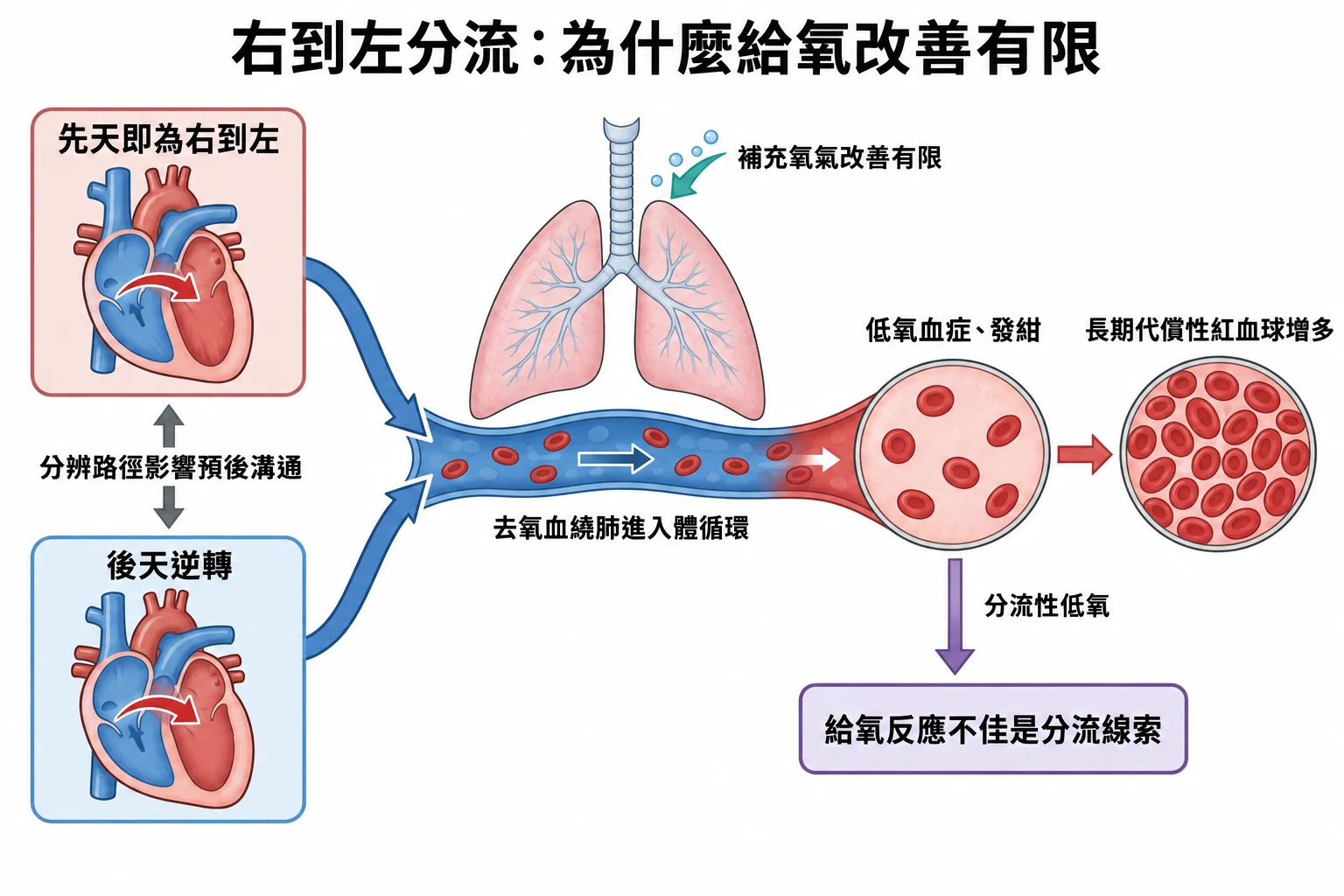 右到左分流:為什麼給氧改善有限教學插圖