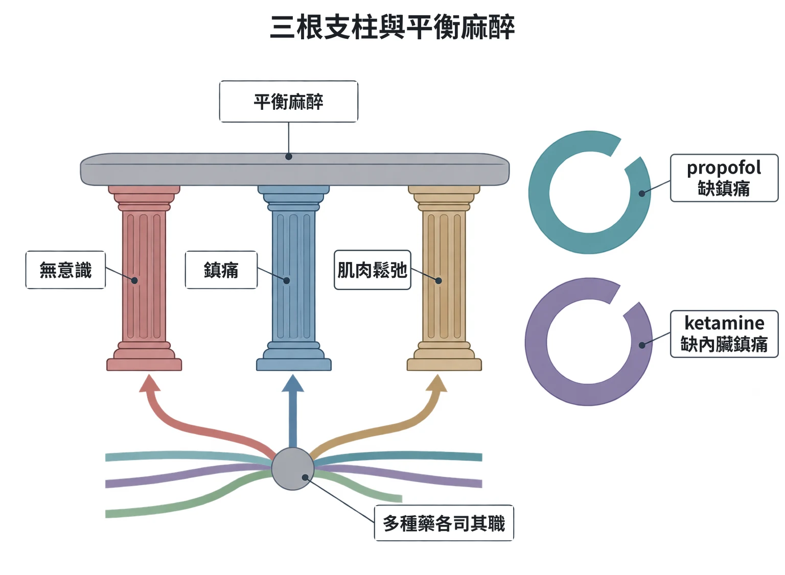 三根支柱與平衡麻醉教學插圖