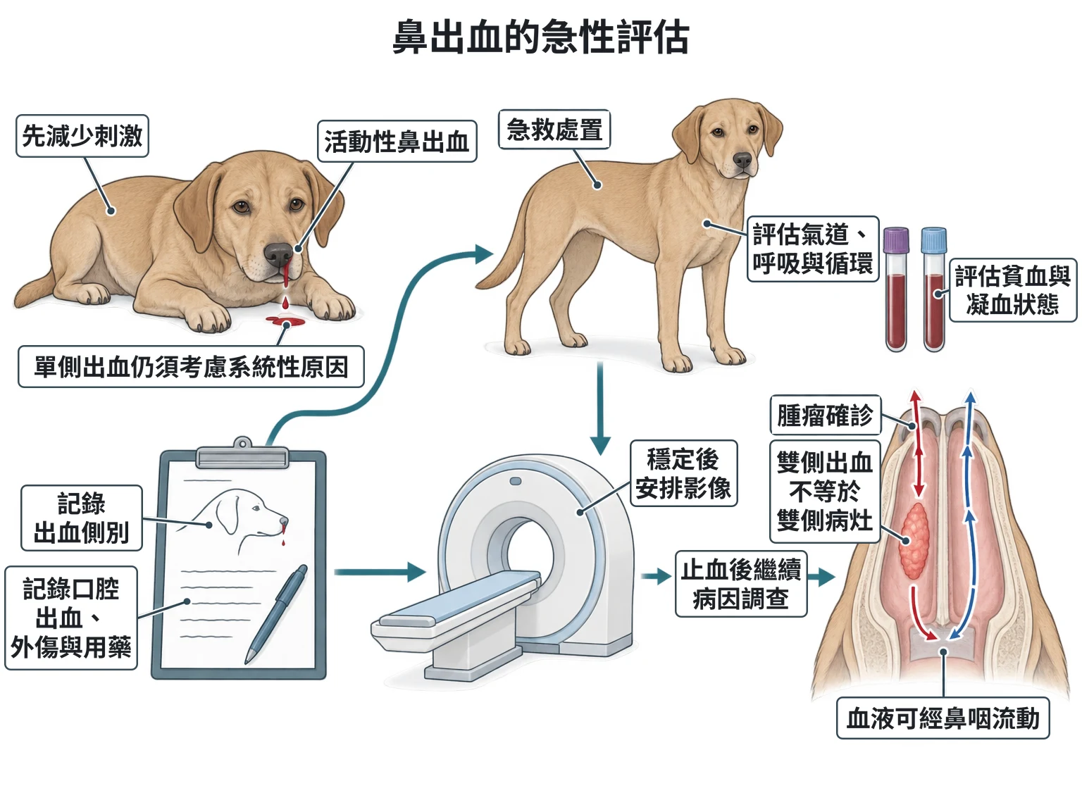 鼻出血的急性評估教學插圖