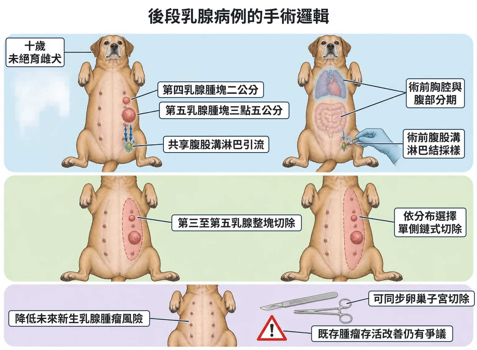 後段乳腺病例的手術邏輯教學插圖