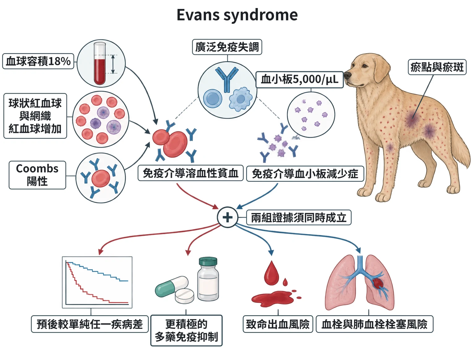 Evans syndrome教學插圖