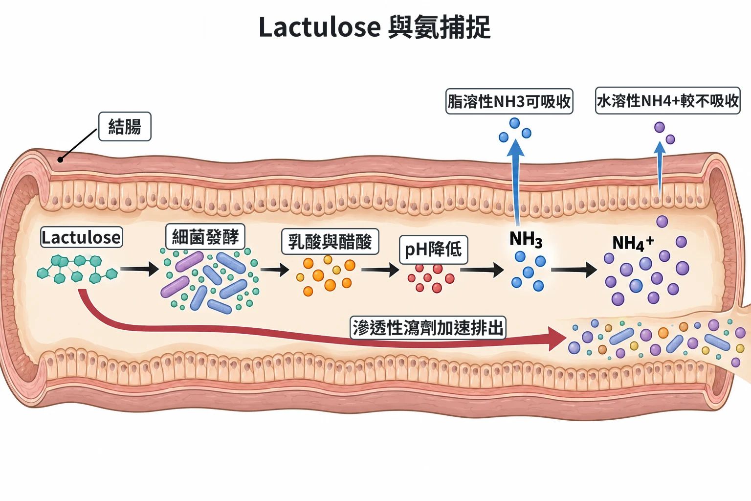 Lactulose 與氨捕捉教學插圖