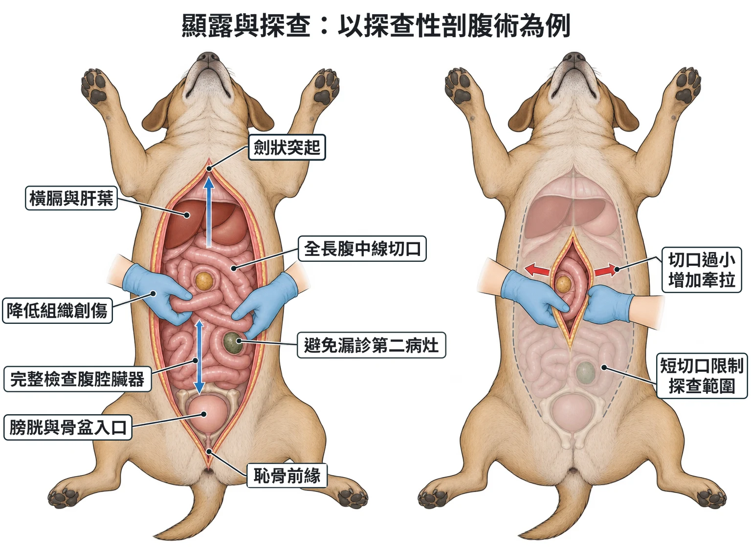 顯露與探查:以探查性剖腹術為例教學插圖