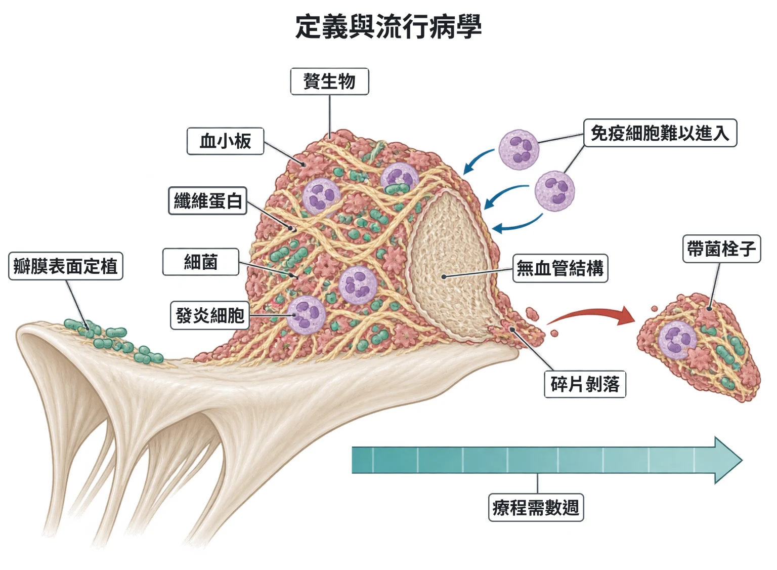 定義與流行病學教學插圖