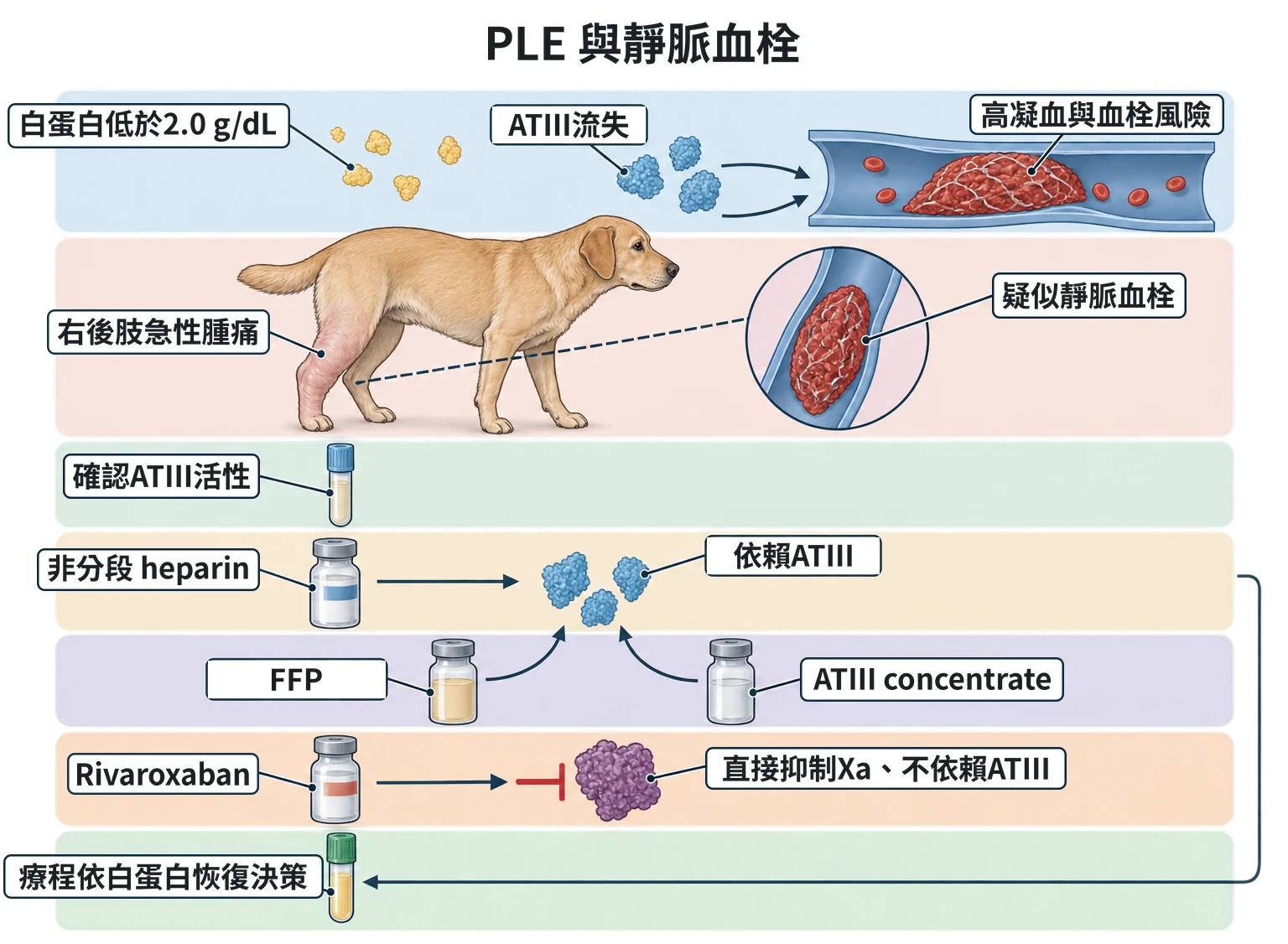 PLE 與靜脈血栓教學插圖