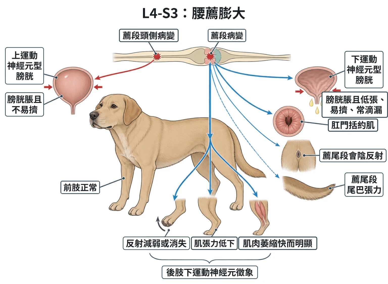 L4-S3:腰薦膨大教學插圖