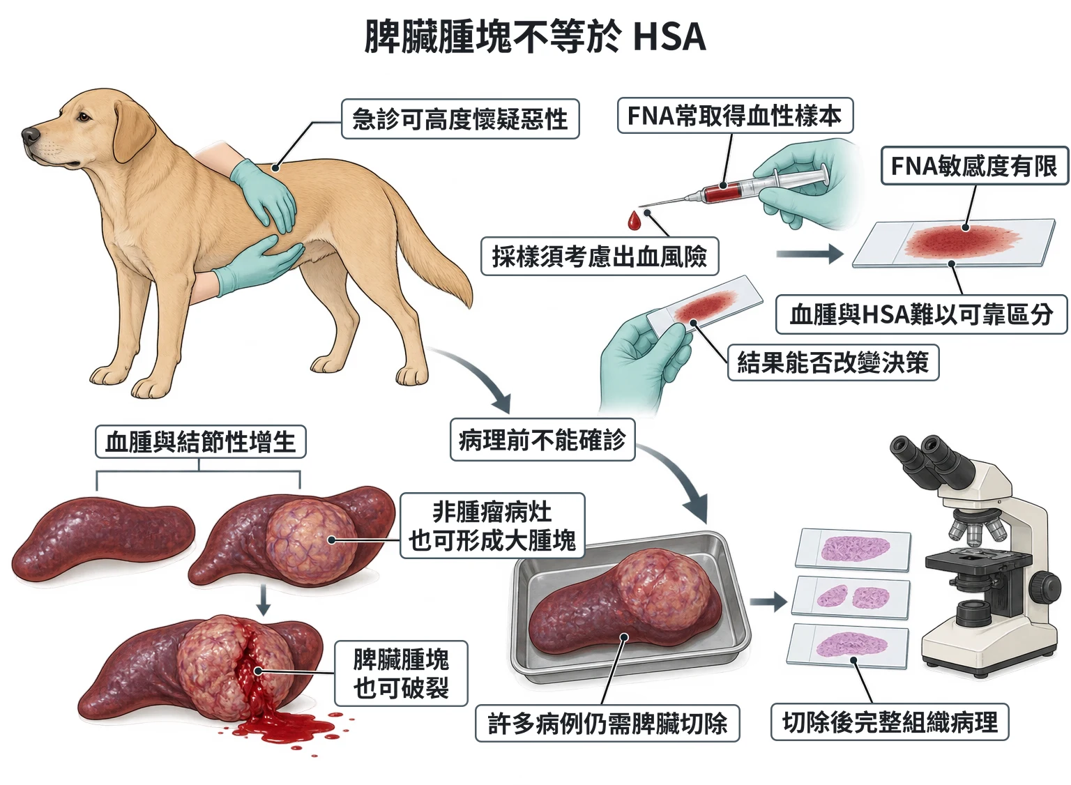 脾臟腫塊不等於 HSA教學插圖