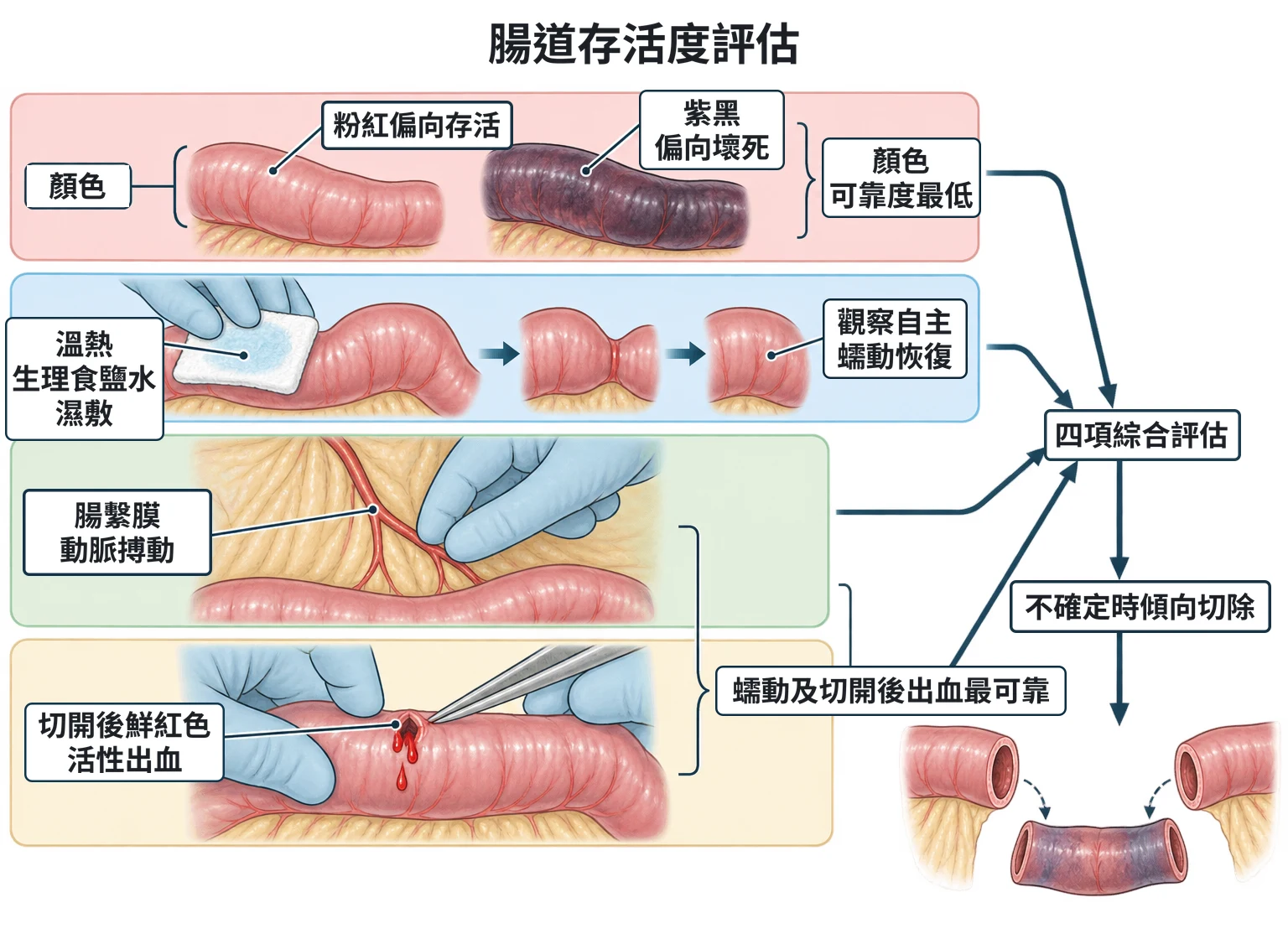 腸道存活度評估教學插圖