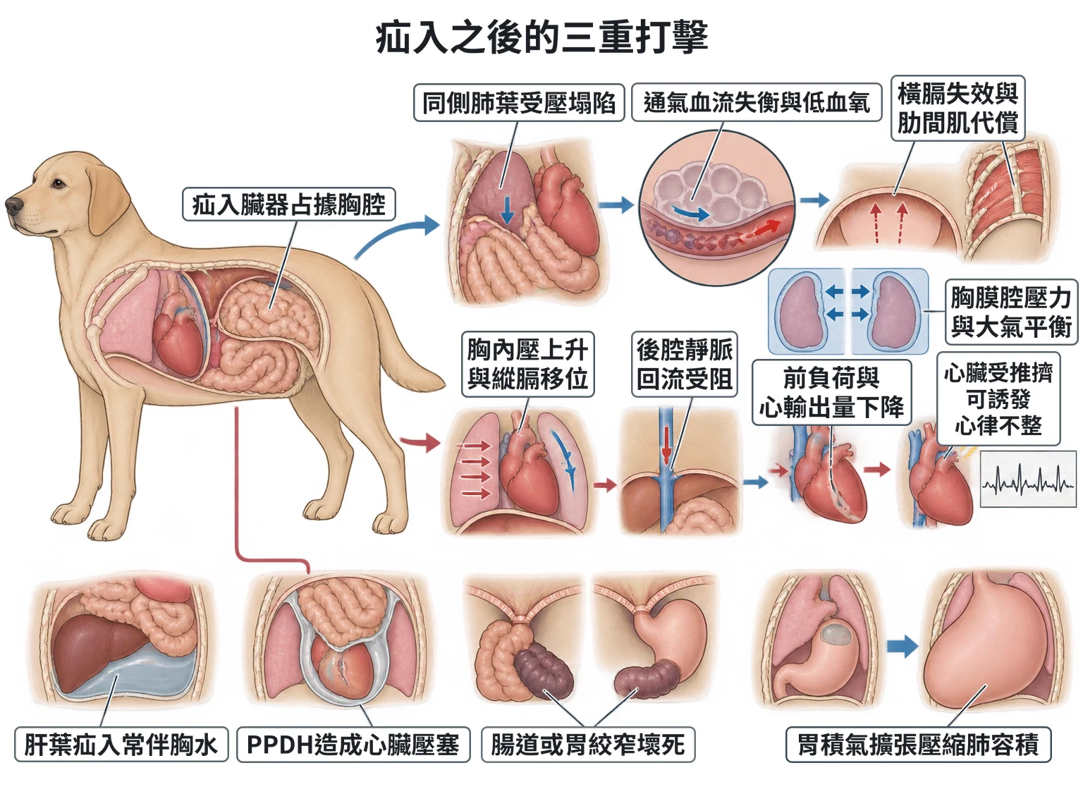 疝入之後的三重打擊教學插圖
