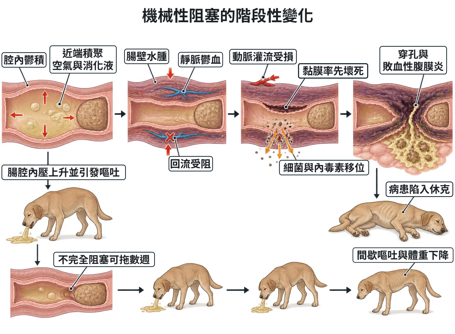 機械性阻塞的階段性變化教學插圖
