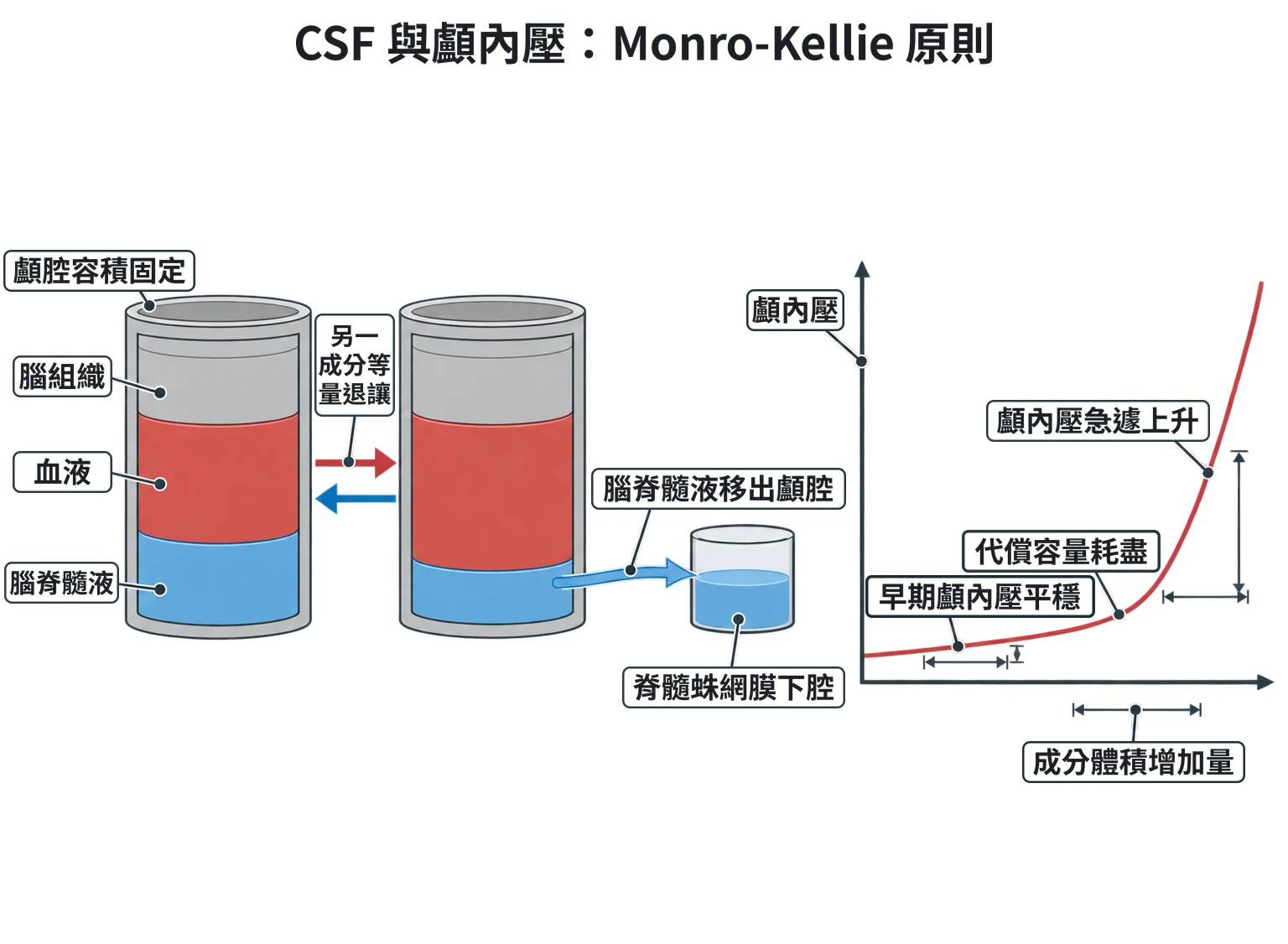 CSF 與顱內壓:Monro-Kellie 原則教學插圖