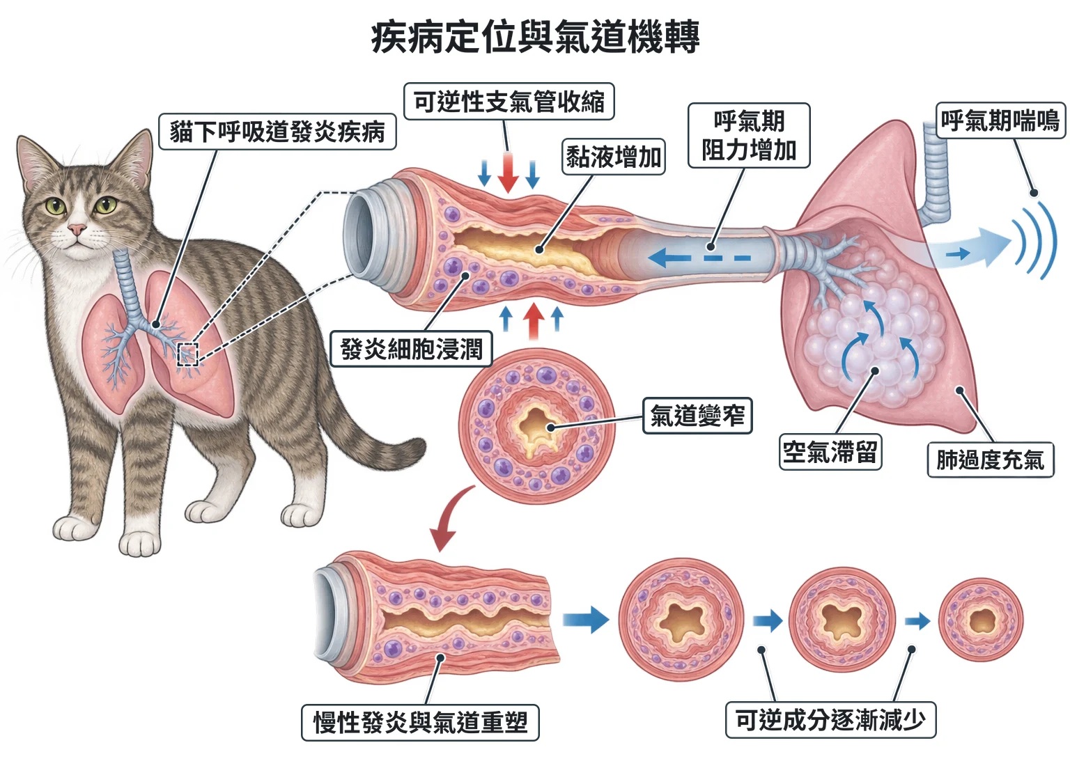 疾病定位與氣道機轉教學插圖