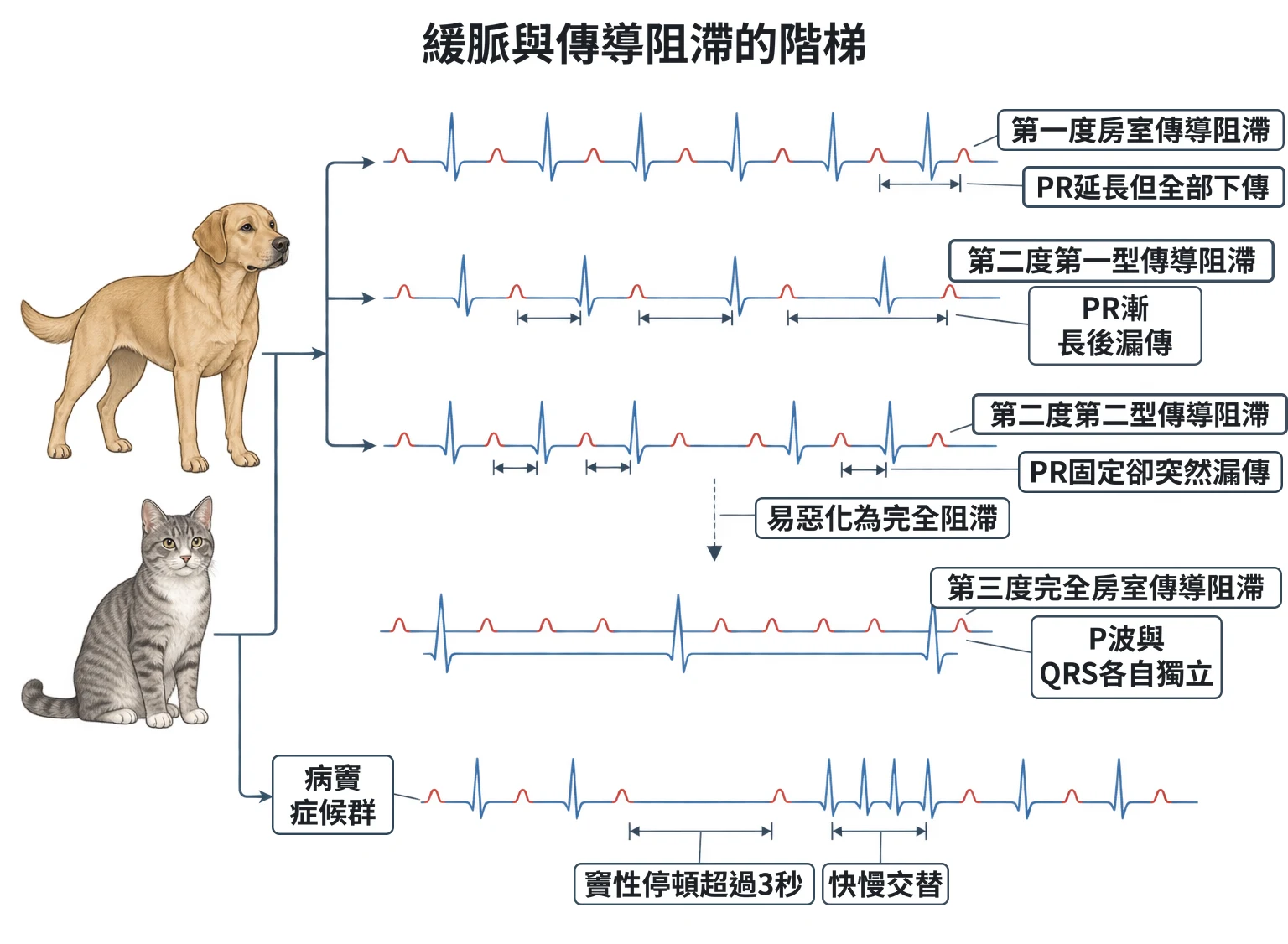 緩脈與傳導阻滯的階梯教學插圖