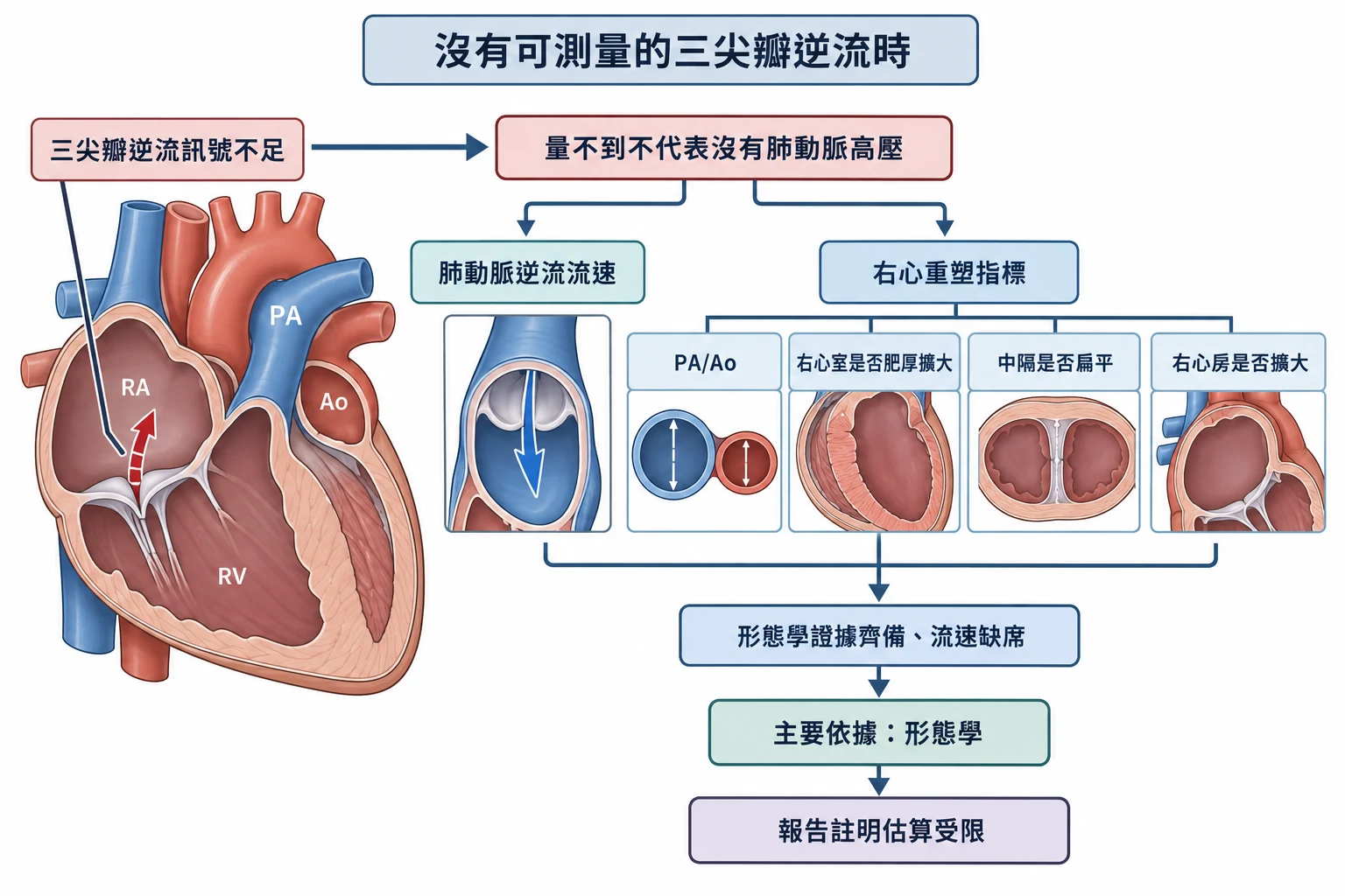 沒有可測量的三尖瓣逆流時教學插圖