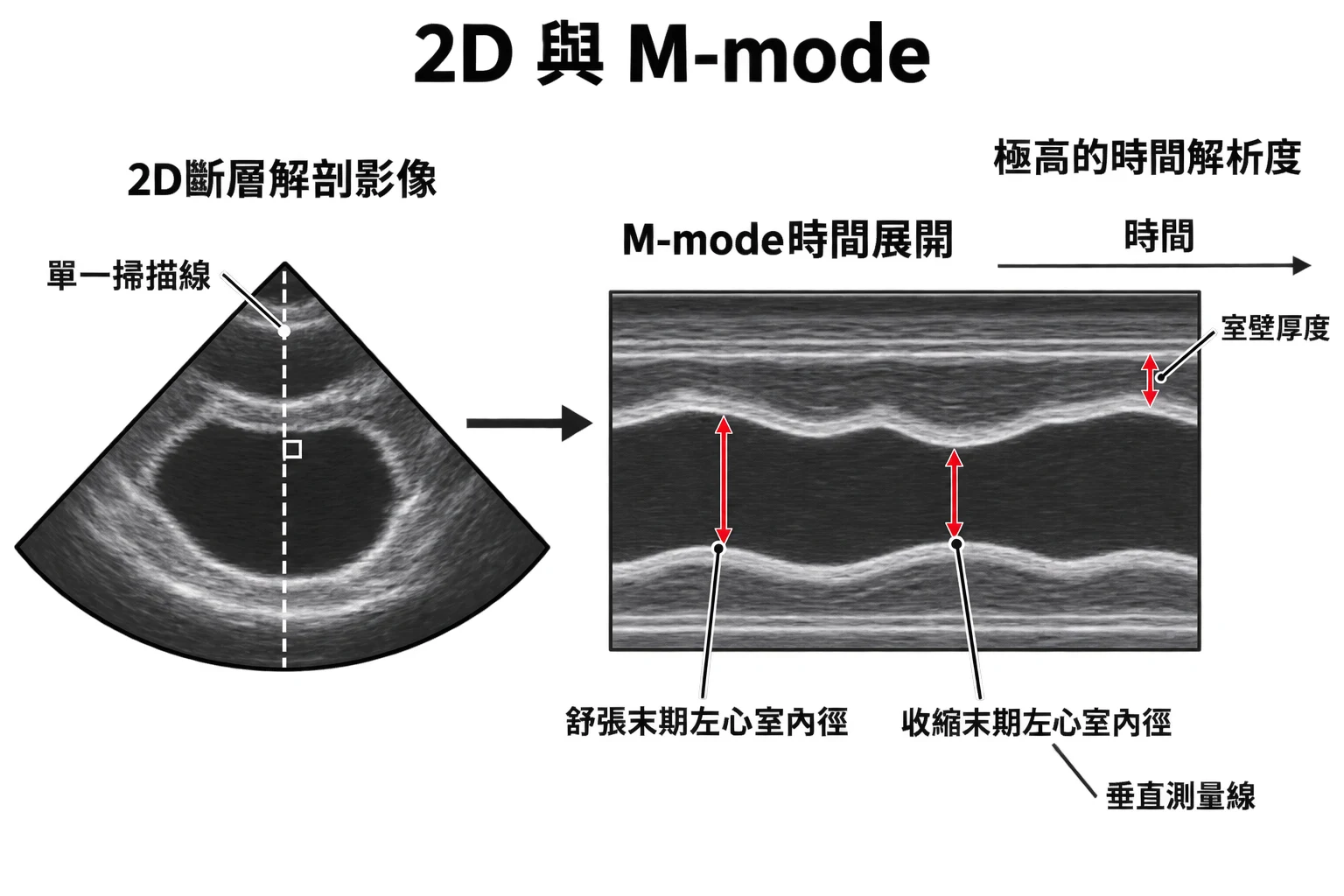 2D 與 M-mode教學插圖