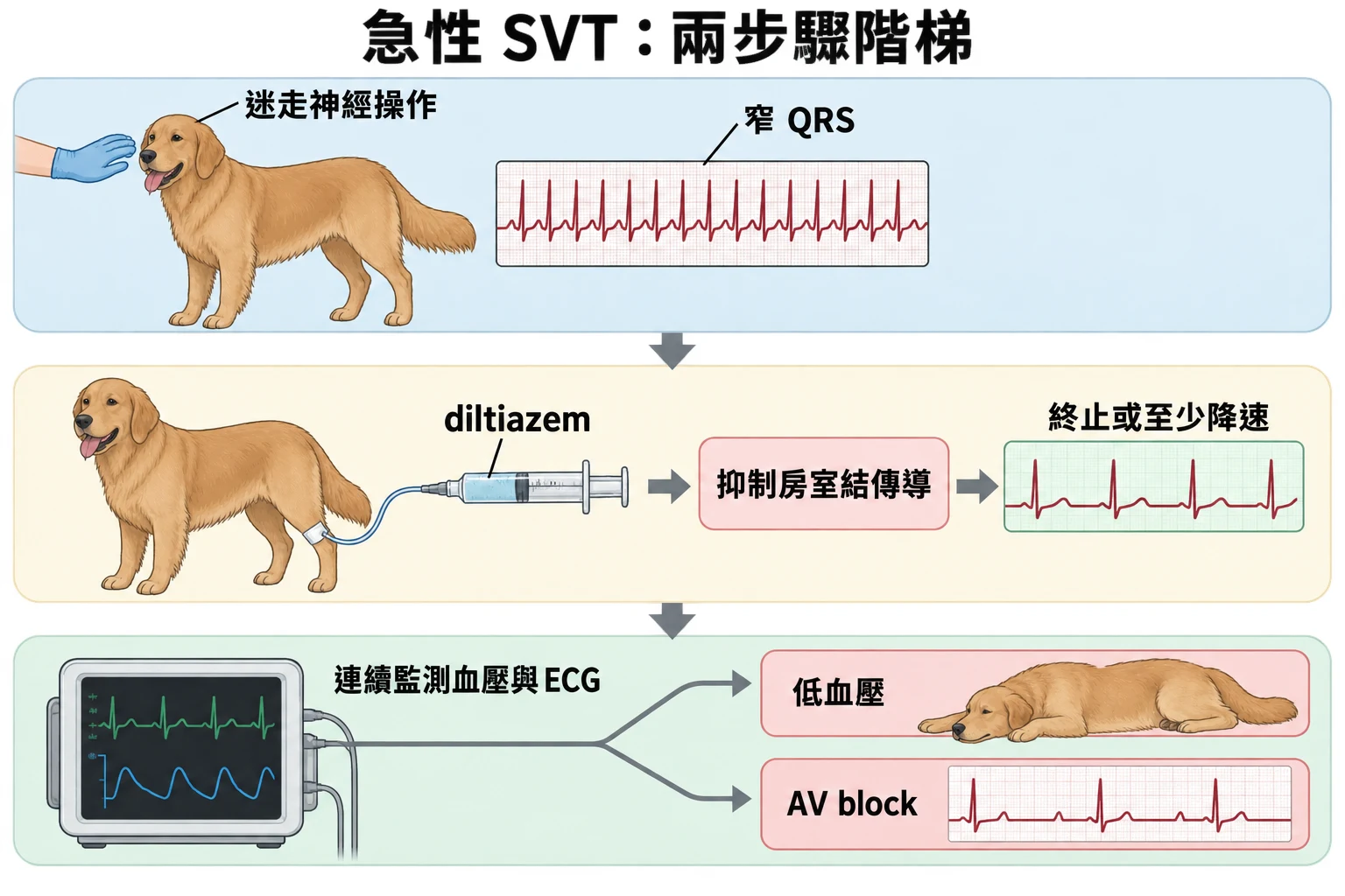 急性 SVT:兩步驟階梯教學插圖