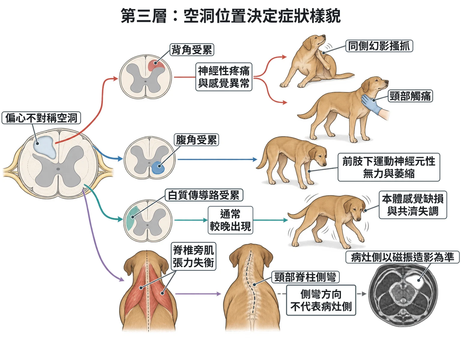 第三層:空洞位置決定症狀樣貌教學插圖
