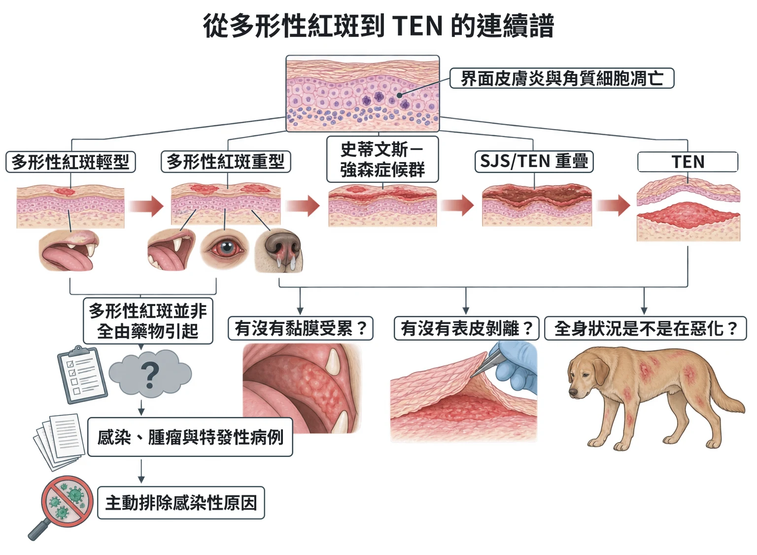 從多形性紅斑到 TEN 的連續譜教學插圖