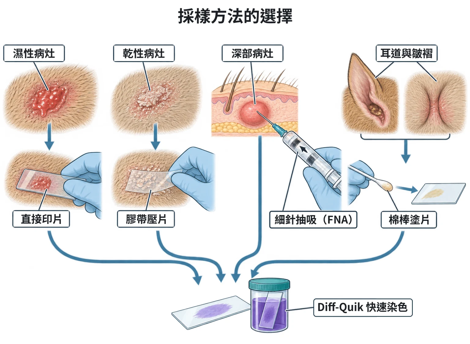 採樣方法的選擇教學插圖