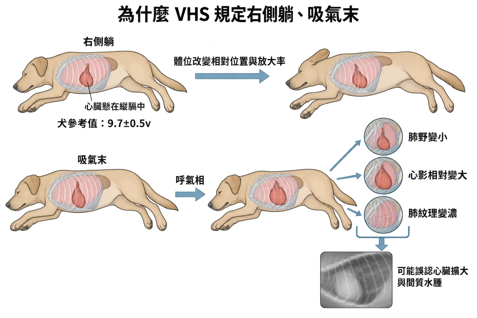 為什麼 VHS 規定右側躺、吸氣末教學插圖