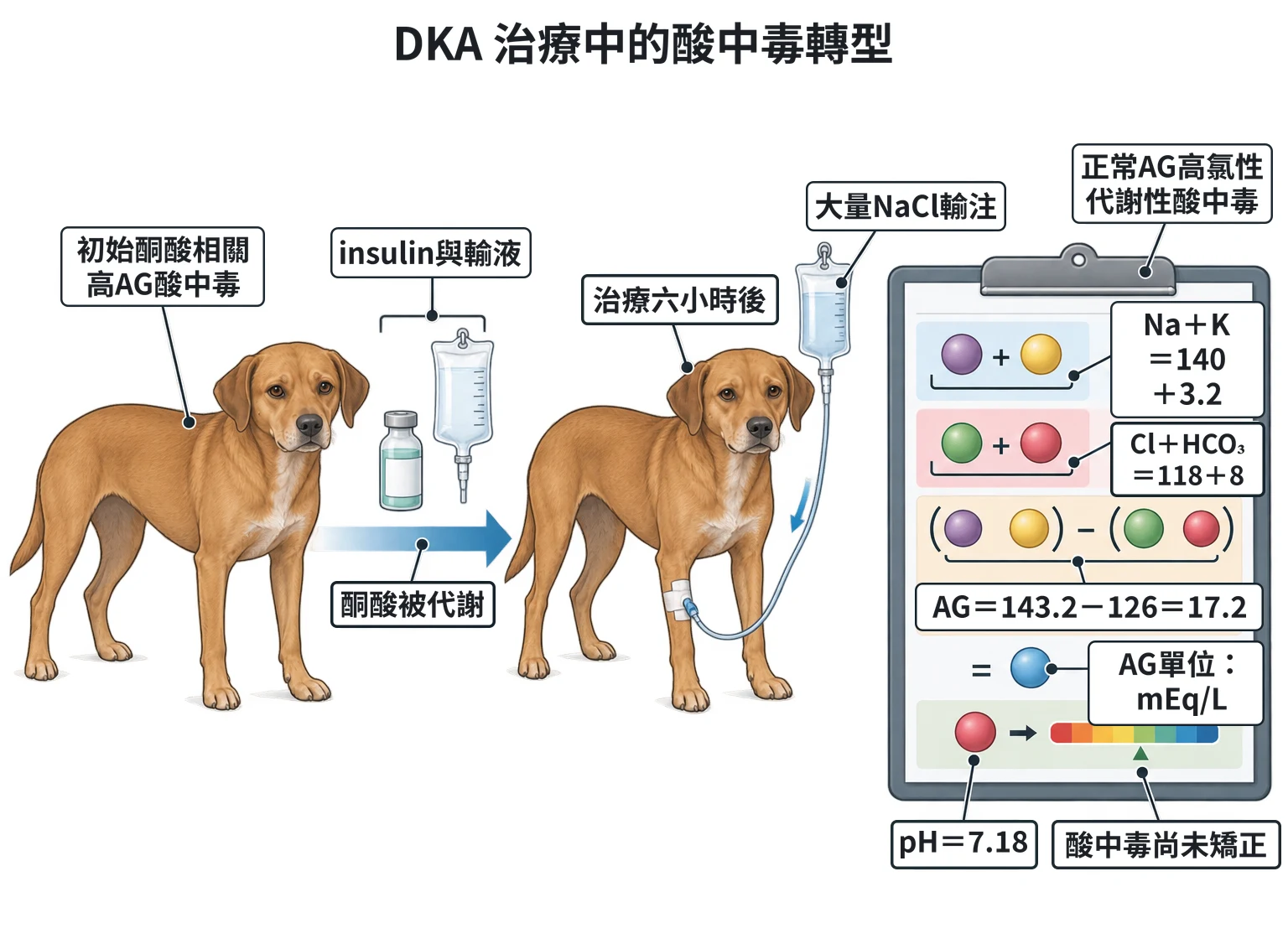 DKA 治療中的酸中毒轉型教學插圖