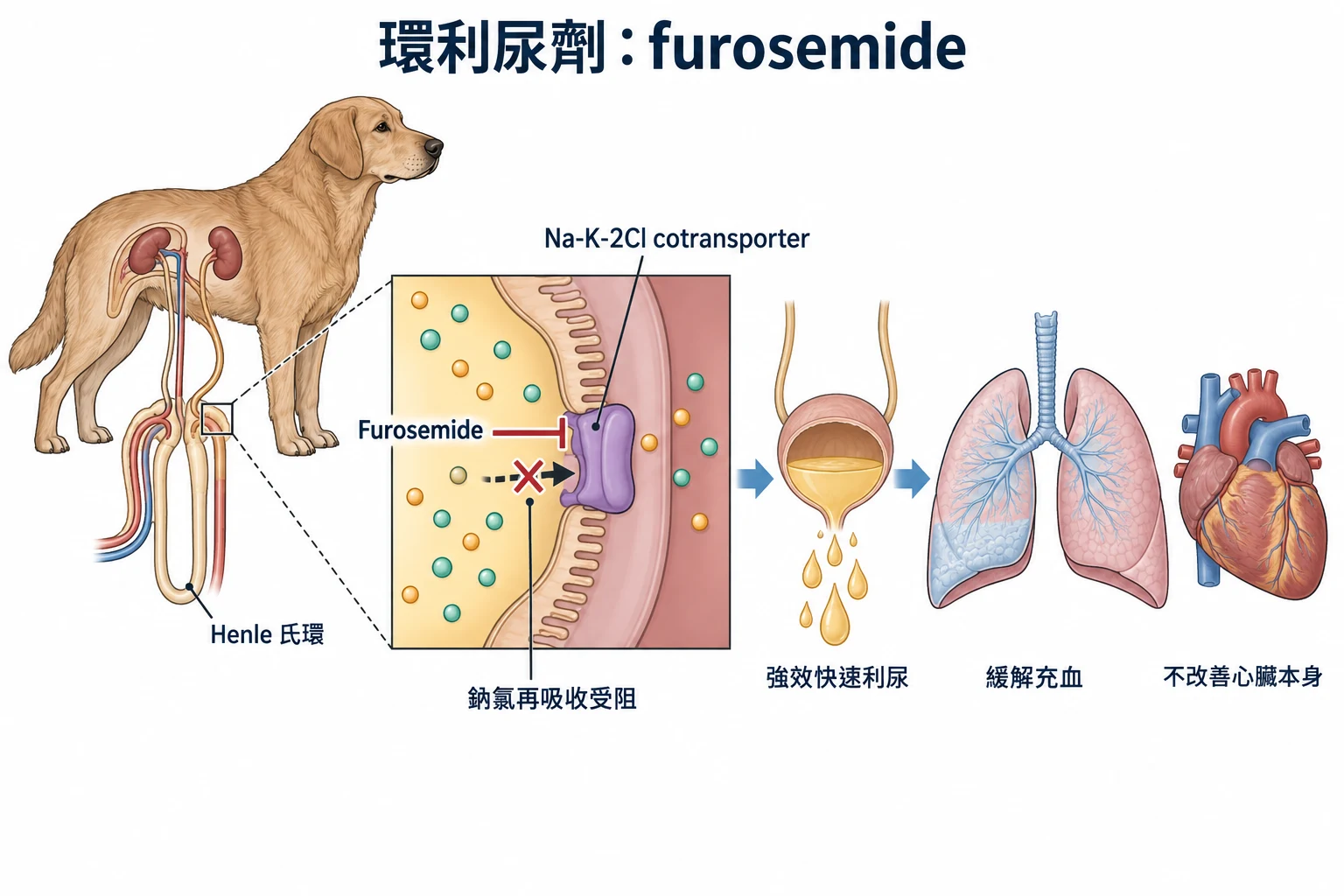 環利尿劑:furosemide教學插圖
