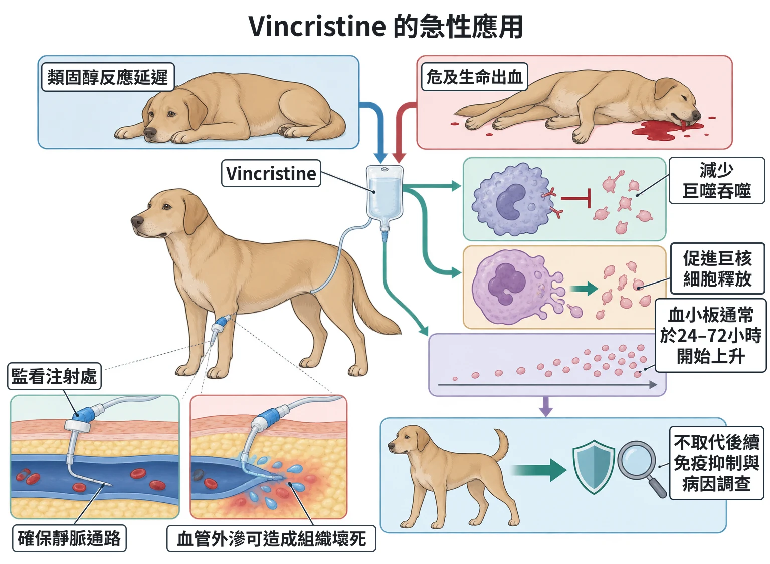 Vincristine 的急性應用教學插圖