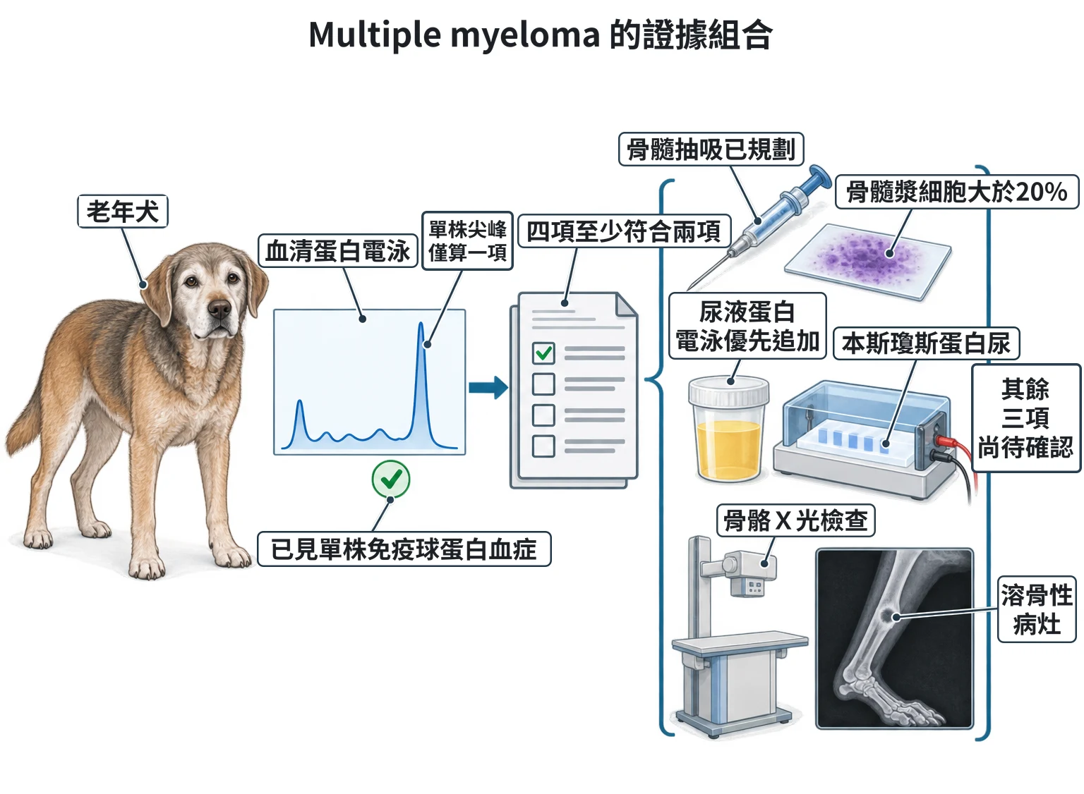 Multiple myeloma 的證據組合教學插圖