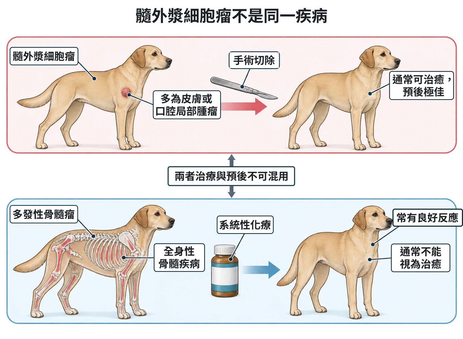髓外漿細胞瘤不是同一疾病教學插圖