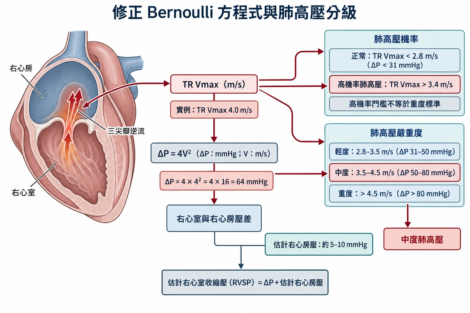 修正 Bernoulli 方程式與肺高壓分級教學插圖