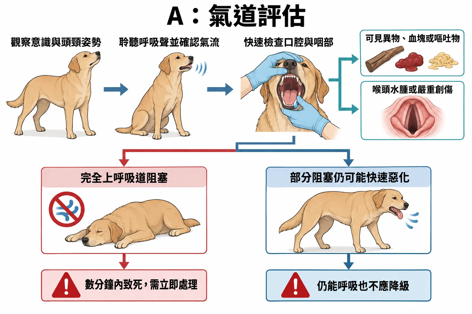 A:氣道評估教學插圖